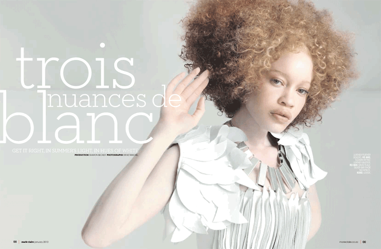 Albino Model Challenges Perceptions of Beauty in the Fashion Industry 
