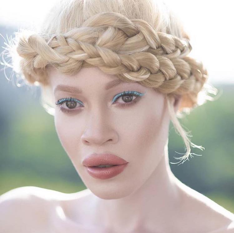 Model with Albinism Challenges Perceptions of Beauty in the Fashion Industry
