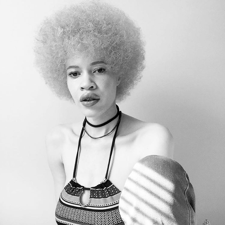 Albino Model Challenges Perceptions of Beauty in the Fashion Industry 