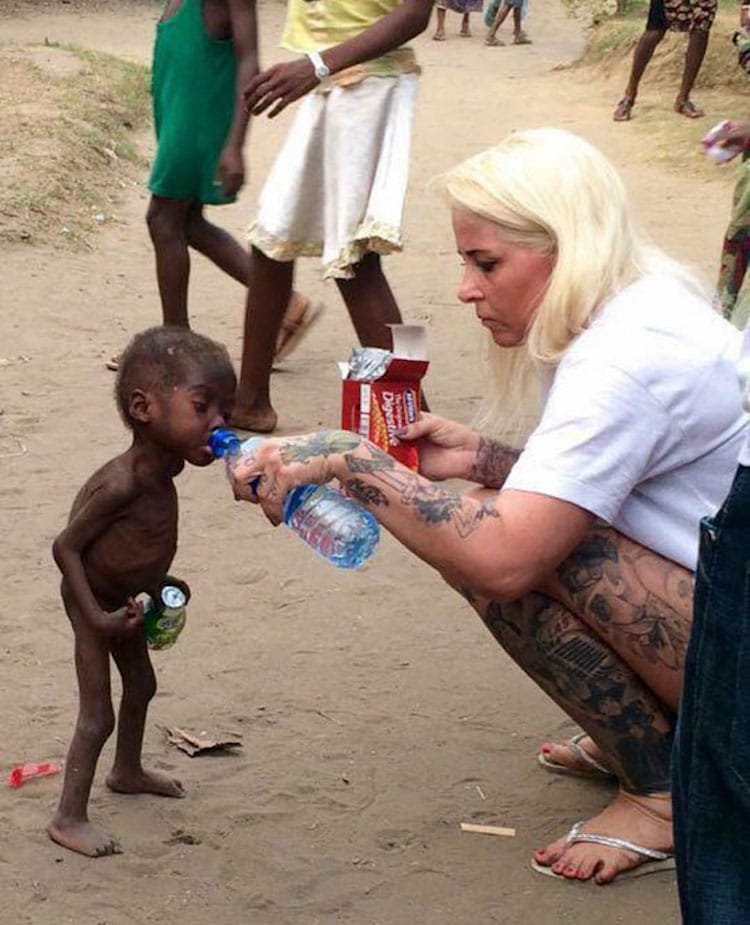 3-Year-Old Boy Named Hope Now Thrives After Almost Starving