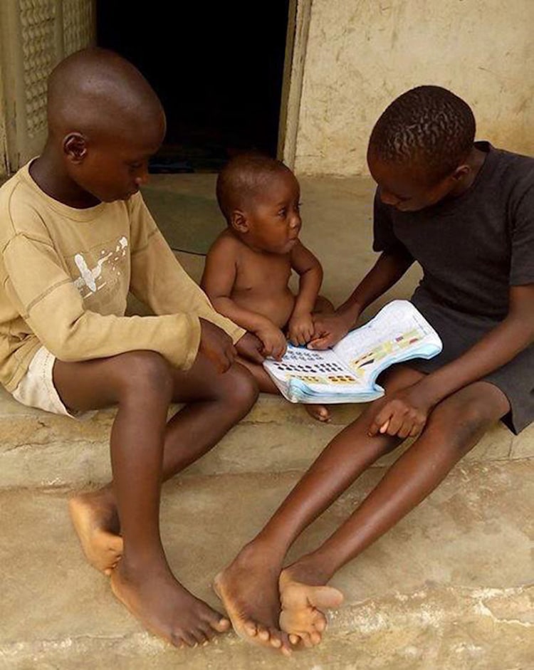 Hope, un garçon de 3 ans, prospère maintenant après avoir failli mourir de faim