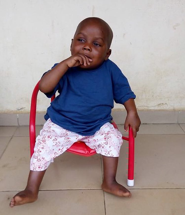 3-Year-Old Boy Named Hope Now Thrives After Almost Starving