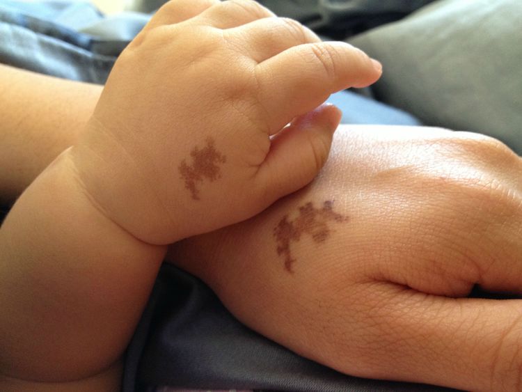 most creative birthmark tattoos