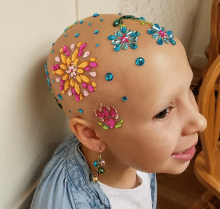 crazy hair day alopecia daniella vinanti wride ginessa inspiring stories