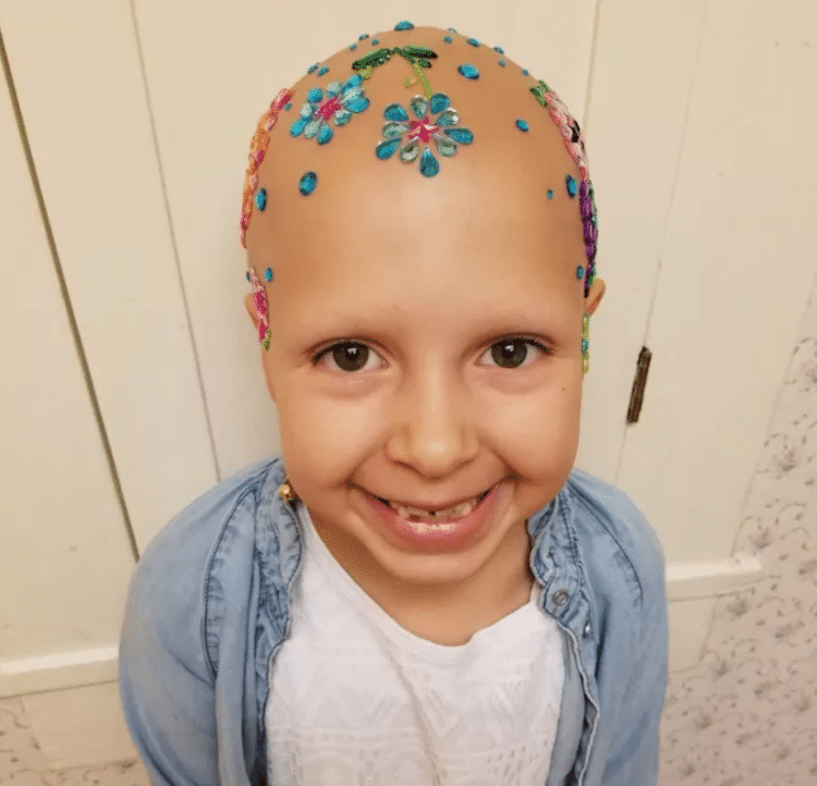 crazy hair day alopecia daniella vinanti wride ginessa inspiring stories