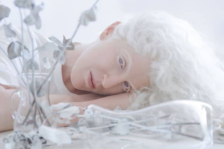Porcelain Beauty 2 Yulia Taits Pictures of Albinism People with Albinism
