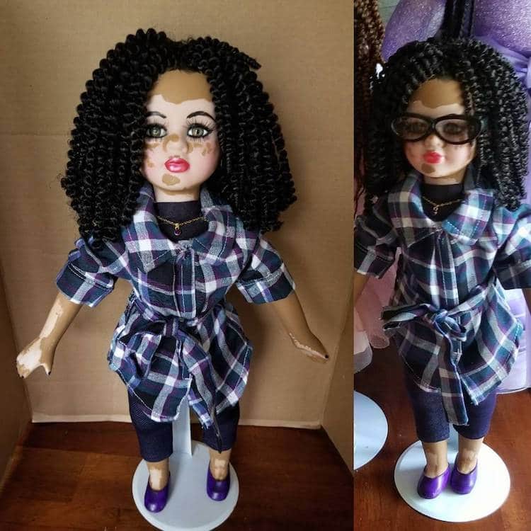 Custom Dolls with Vitiligo by Kay Custom 