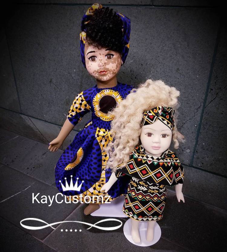 Custom Made Dolls with Vitiligo by Kay Custom 