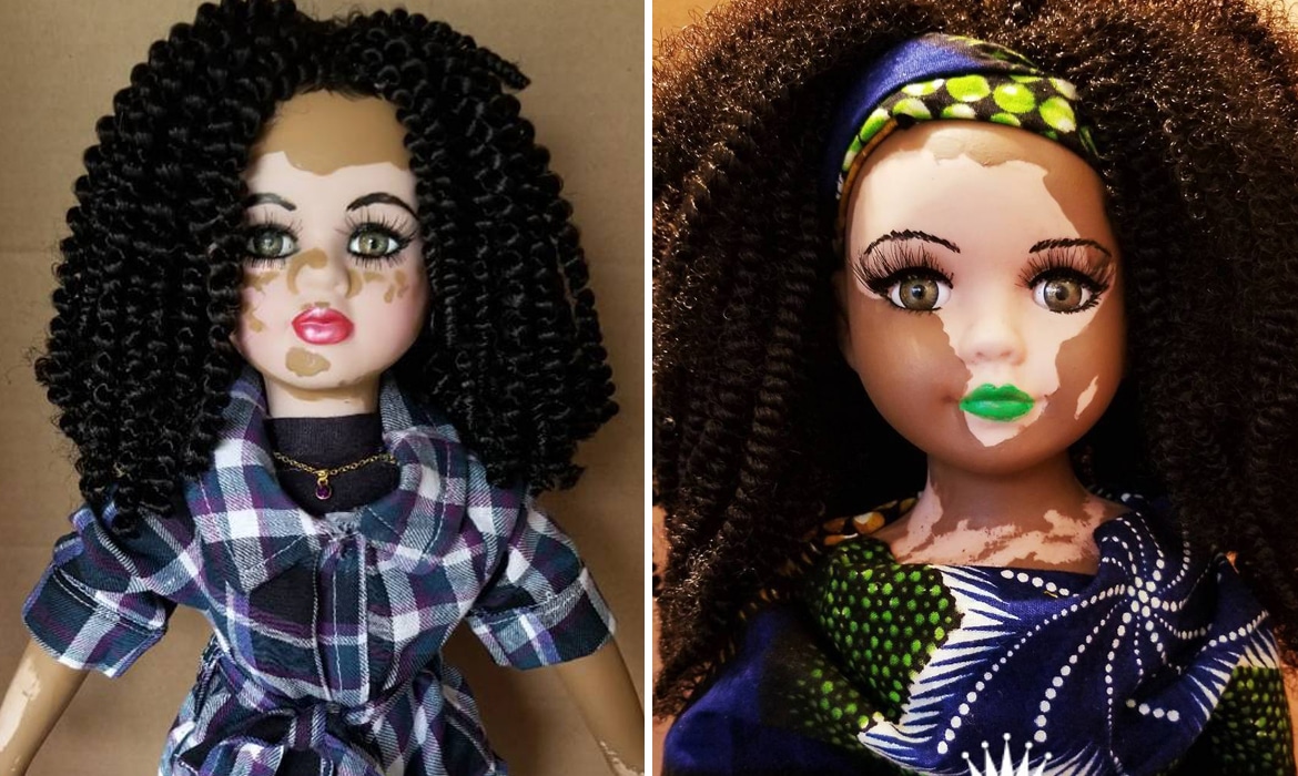 Custom Made Dolls with Vitiligo by Kay Custom 