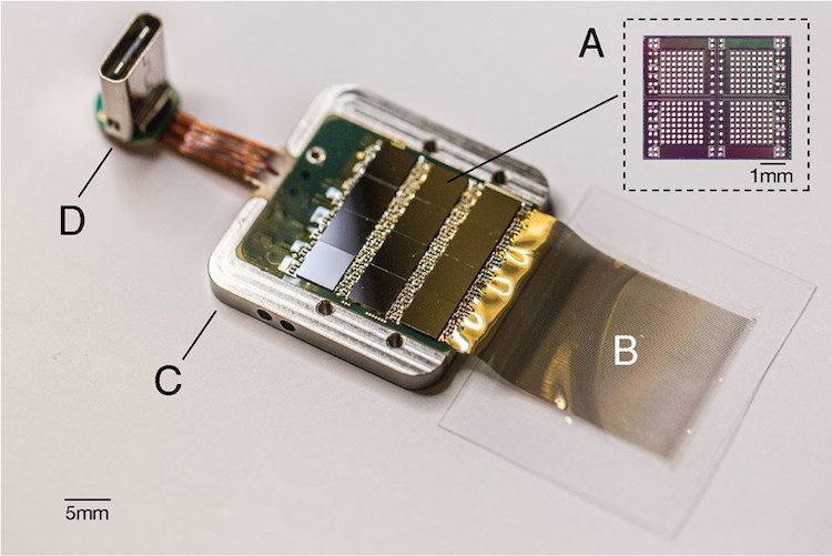 Neural Implant by Neuralink