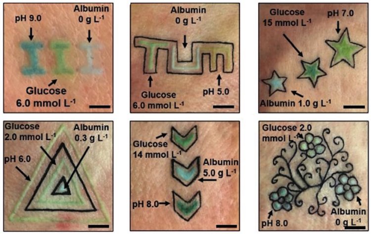 Tatuajes para diabéticos que cambian de color