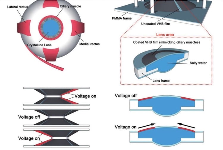 Blink and Zoom Contact Lens