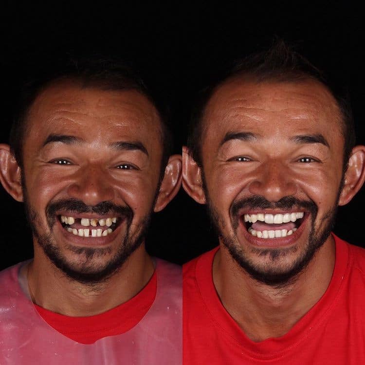 Dentista Felipe Rossi arregla los dientes de gente pobre