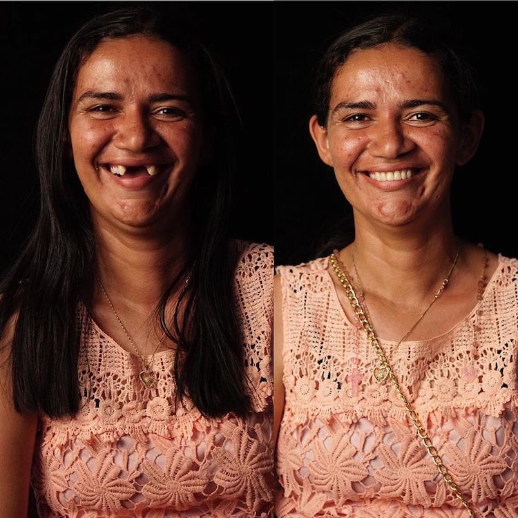 Dentist Felipe Rossi Fixes Teeth of Poor People