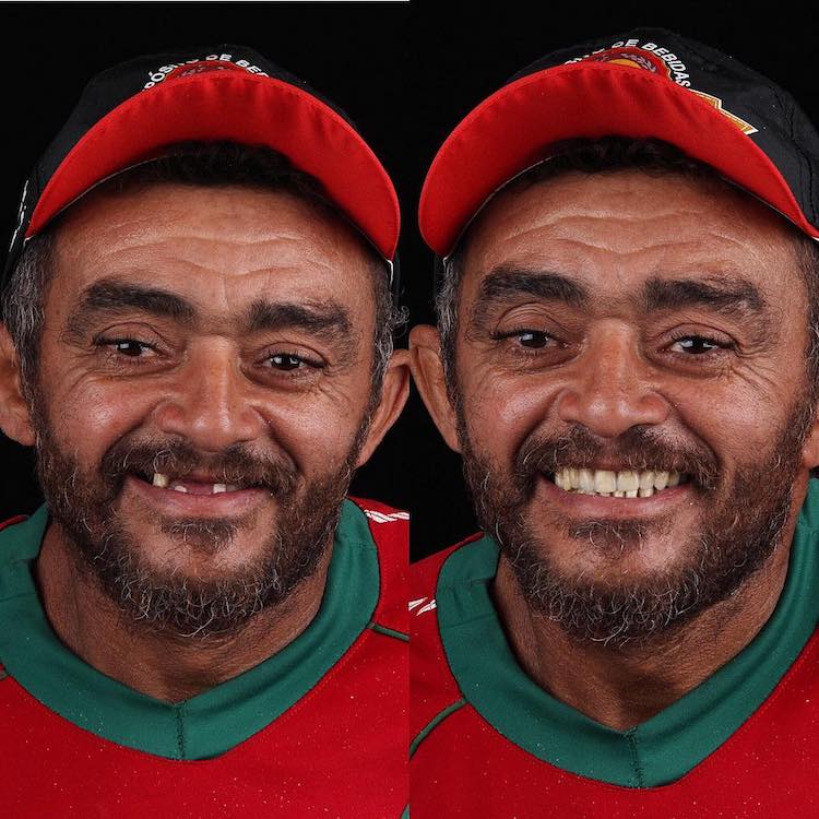 antes y después de dentista