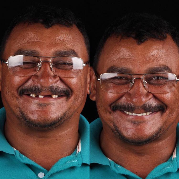 antes y después de dentista