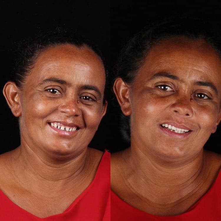 antes y después de dentista