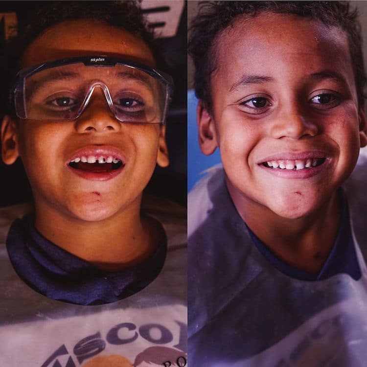 Dentist Felipe Rossi Fixes Teeth of Poor People