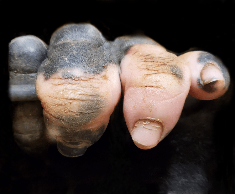 Gorilla With Vitiligo Has Pink And White Fingers That Look Like A Human Hand My Modern Met Bloglovin