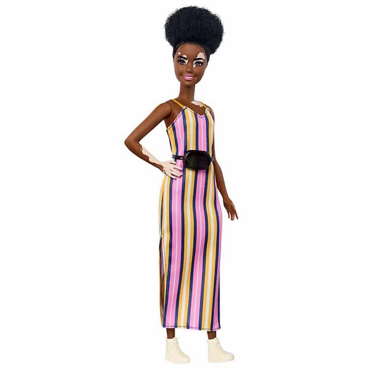 Muñeca con vitiligo de Barbie Fashionistas