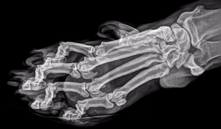 X Ray of an Amur Tiger's Foot