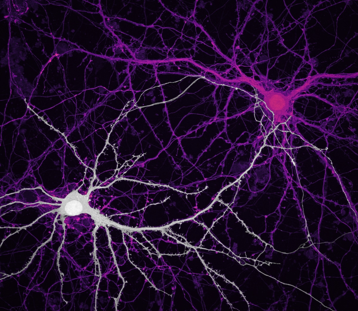 Confocal Image of Connections between hippocampal neurons 