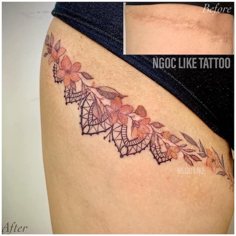 Tatuajes en cicatrices de Ngoc Like Tattoo