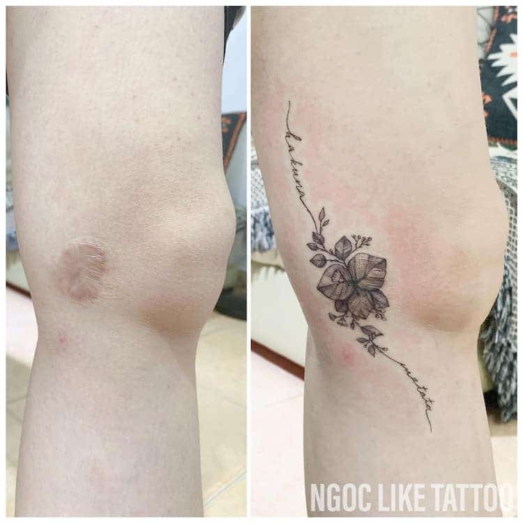 Tatuajes para cubrir cicatrices de Ngoc Like Tattoo