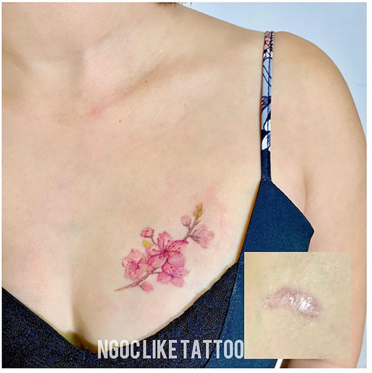 Beautiful' tattoos cover breast cancer scars