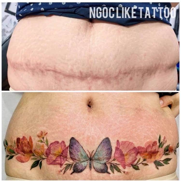 Tatuajes para cicatrices de Ngoc Like Tattoo