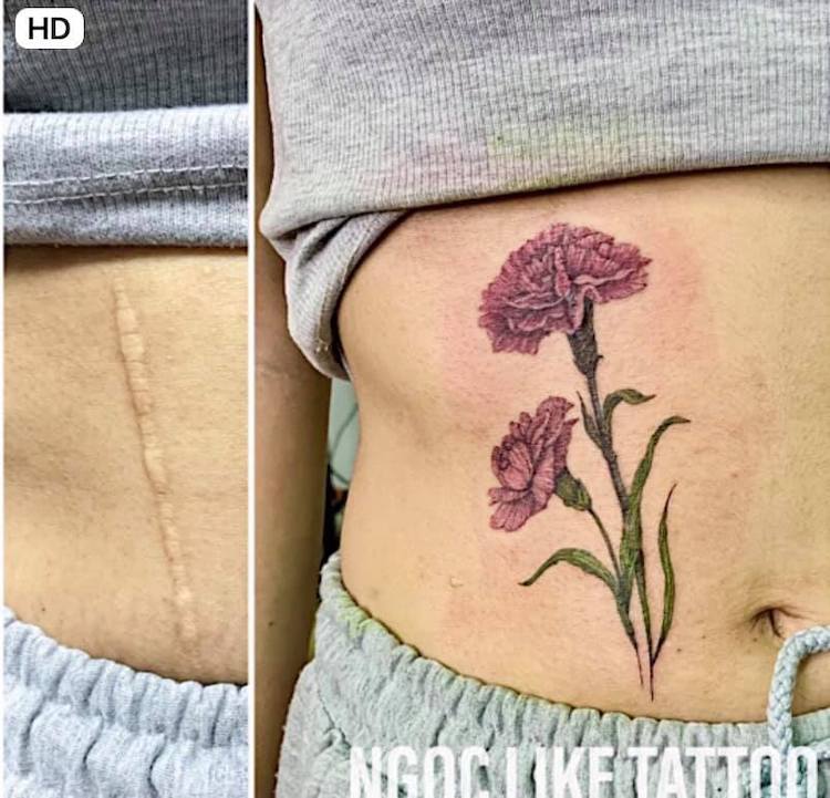 Photos showing how scars are turned into beautiful tattoos  The  Independent  The Independent