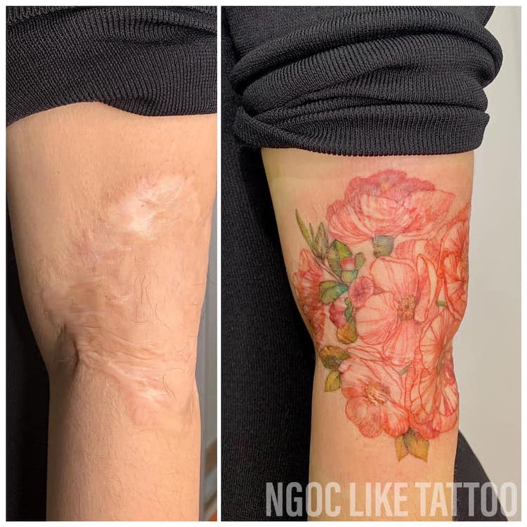 Tatuajes en cicatrices de Ngoc Like Tattoo