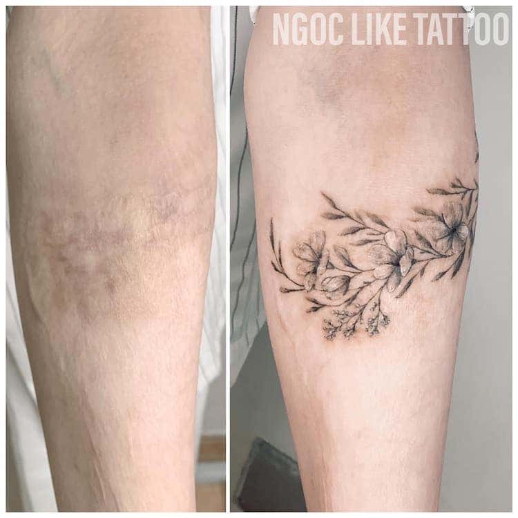 Tatouages sur cicatrices par Ngoc Like Tattoo