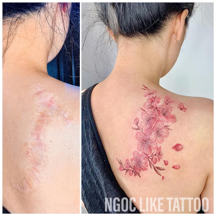 Tatuajes para tapar cicatrices de Ngoc Like Tattoo
