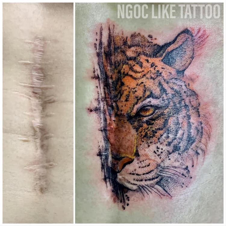 Tatuajes en cicatrices de Ngoc Like Tattoo