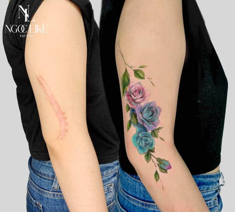 50 Times People Asked To Cover Up Their Scars And This Tattoo Artist  Nailed It New Pics  Bored Panda