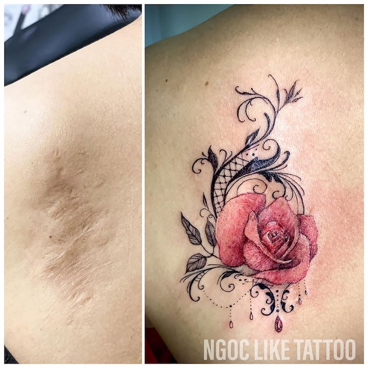 Tatuajes en cicatrices de Ngoc Like Tattoo