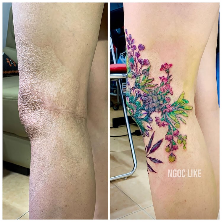 Tatuajes para cubrir cicatrices de Ngoc Like Tattoo