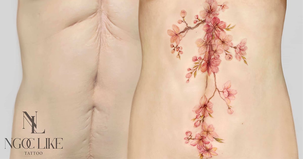 Tattoo Artists Cover Breast Cancer Survivors' Scars With Beautiful Tattoos