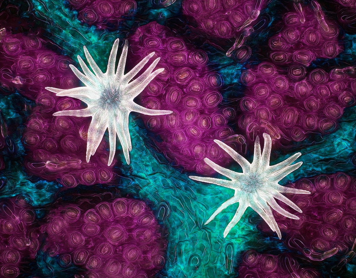 Winner of the Nikon Small World Photomicrography Contest