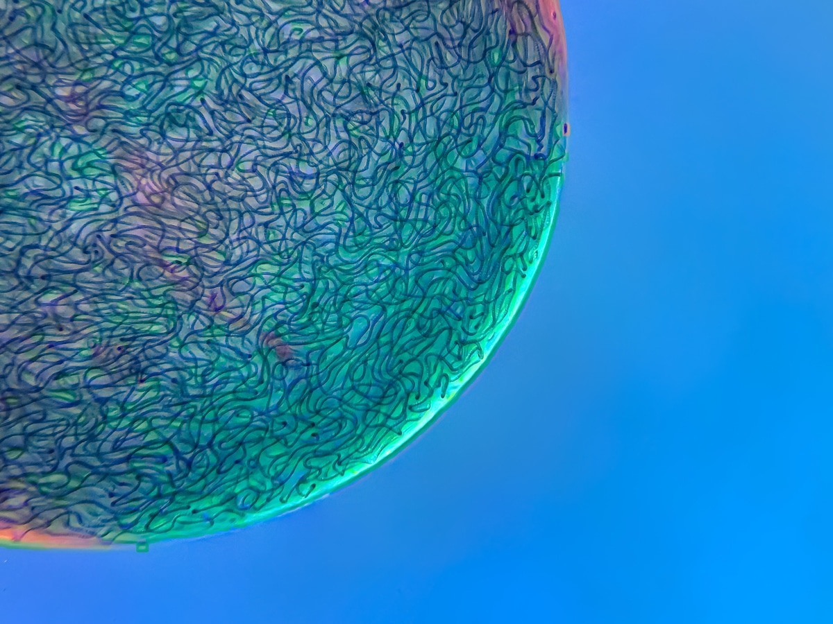 Filamentous strands of Nostoc cyanobacteria 