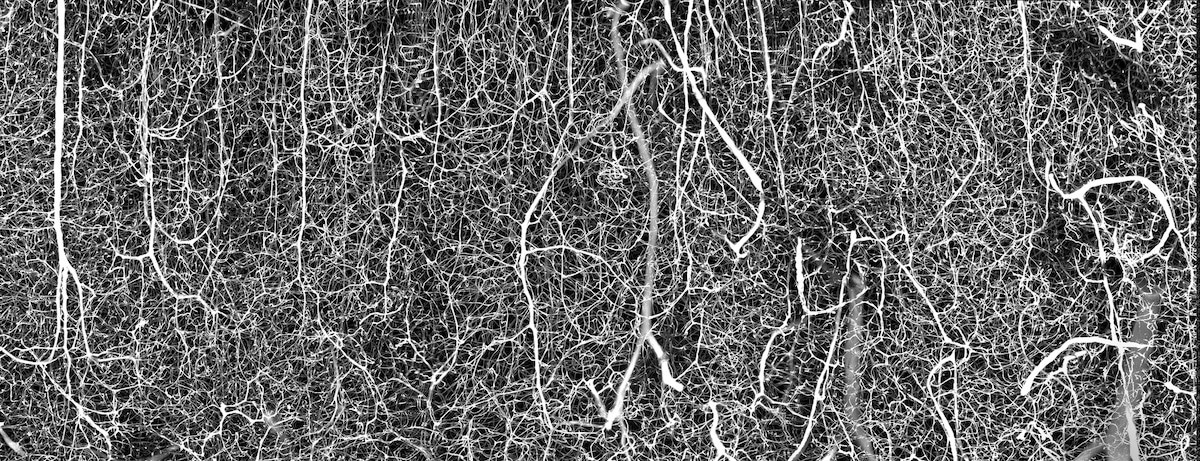 3D vasculature of an adult mouse brain 