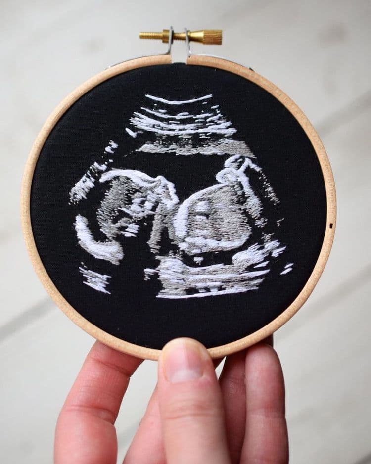 Ultrasound Embroidery by Yulia Sherbak