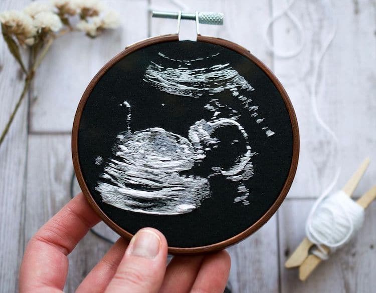 Ultrasound Embroidery by Yulia Sherbak