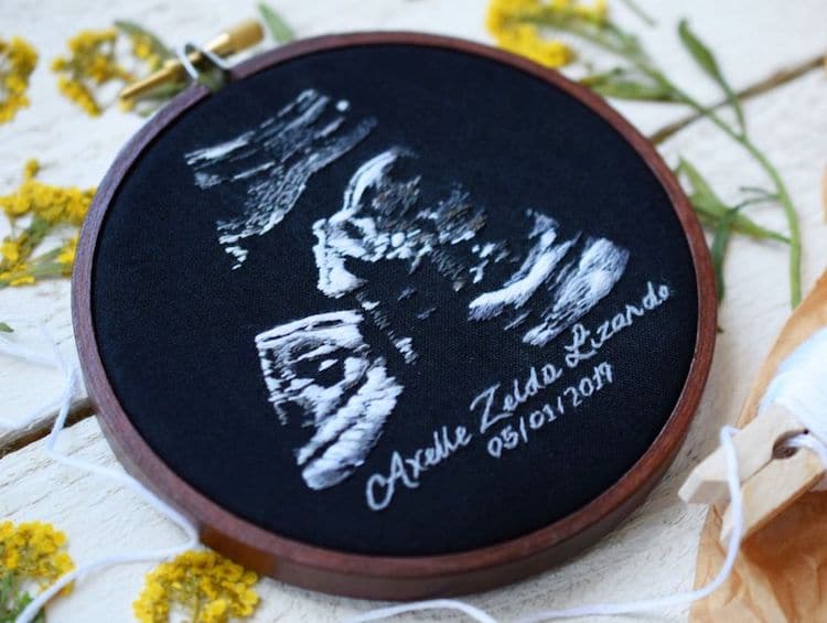 Ultrasound Embroidery by Yulia Sherbak