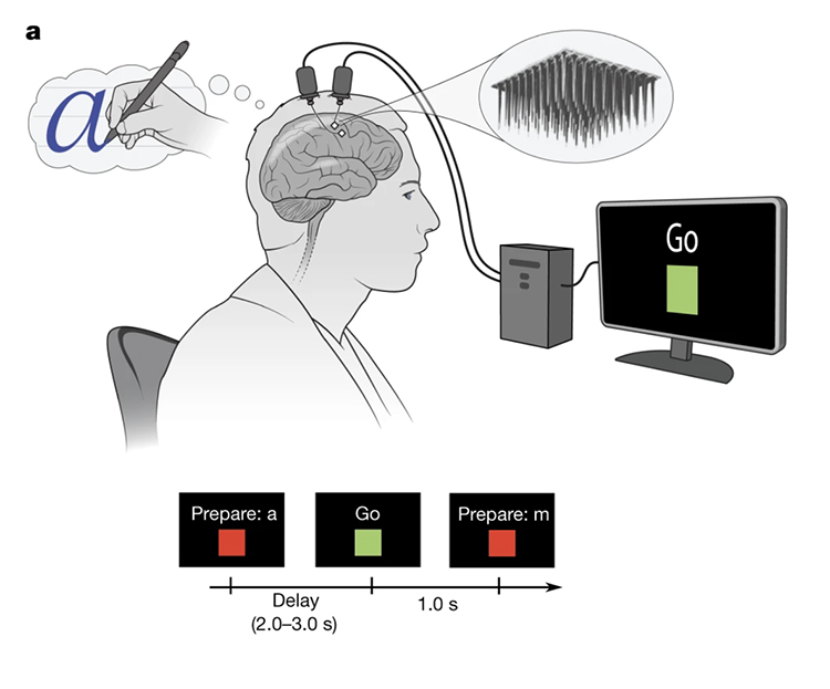 L’interface cerveau-ordinateur utilisée dans l’étude.