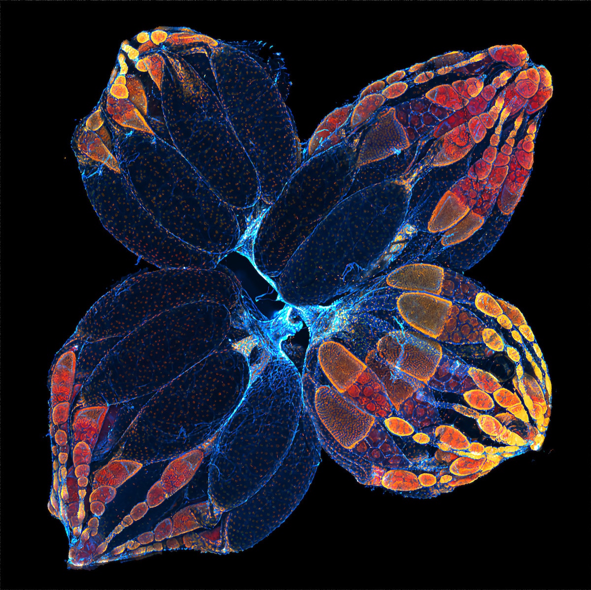 Microscopy of fruit fly ovaries