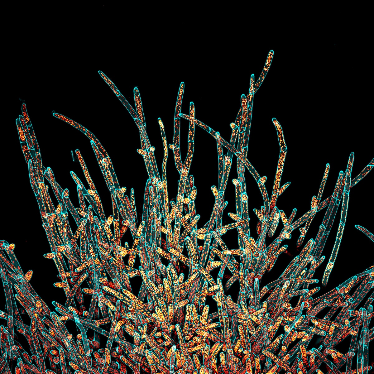 Microscopy of stack of moss Physcomitrium patens protonemal cells