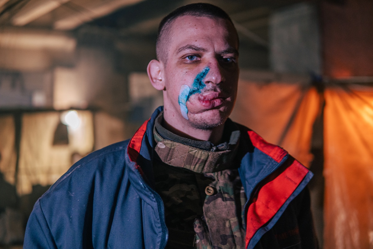 Soldado ucraniano herido en la acería de Mariúpol