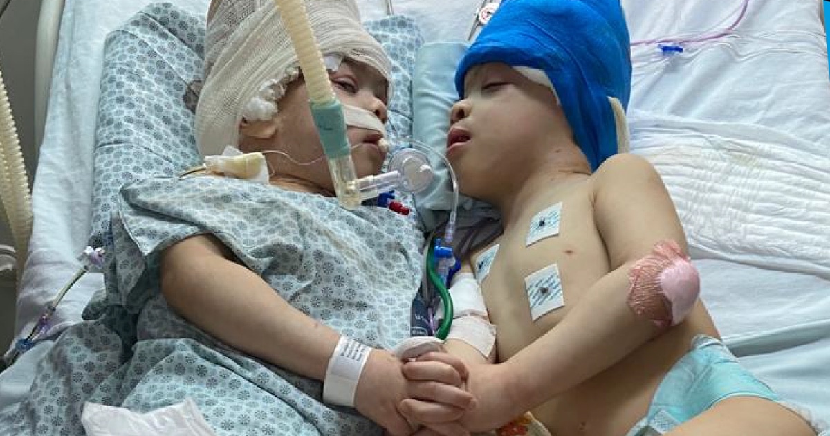 Contact Page screen design idea #437: Surgeons Use Virtual Reality To Separate 3-Year-Old Conjoined Twins With Fused Brains
